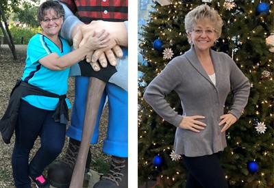 Amy's before and after photos for the great slimdown weight loss program at the golden valley clinic