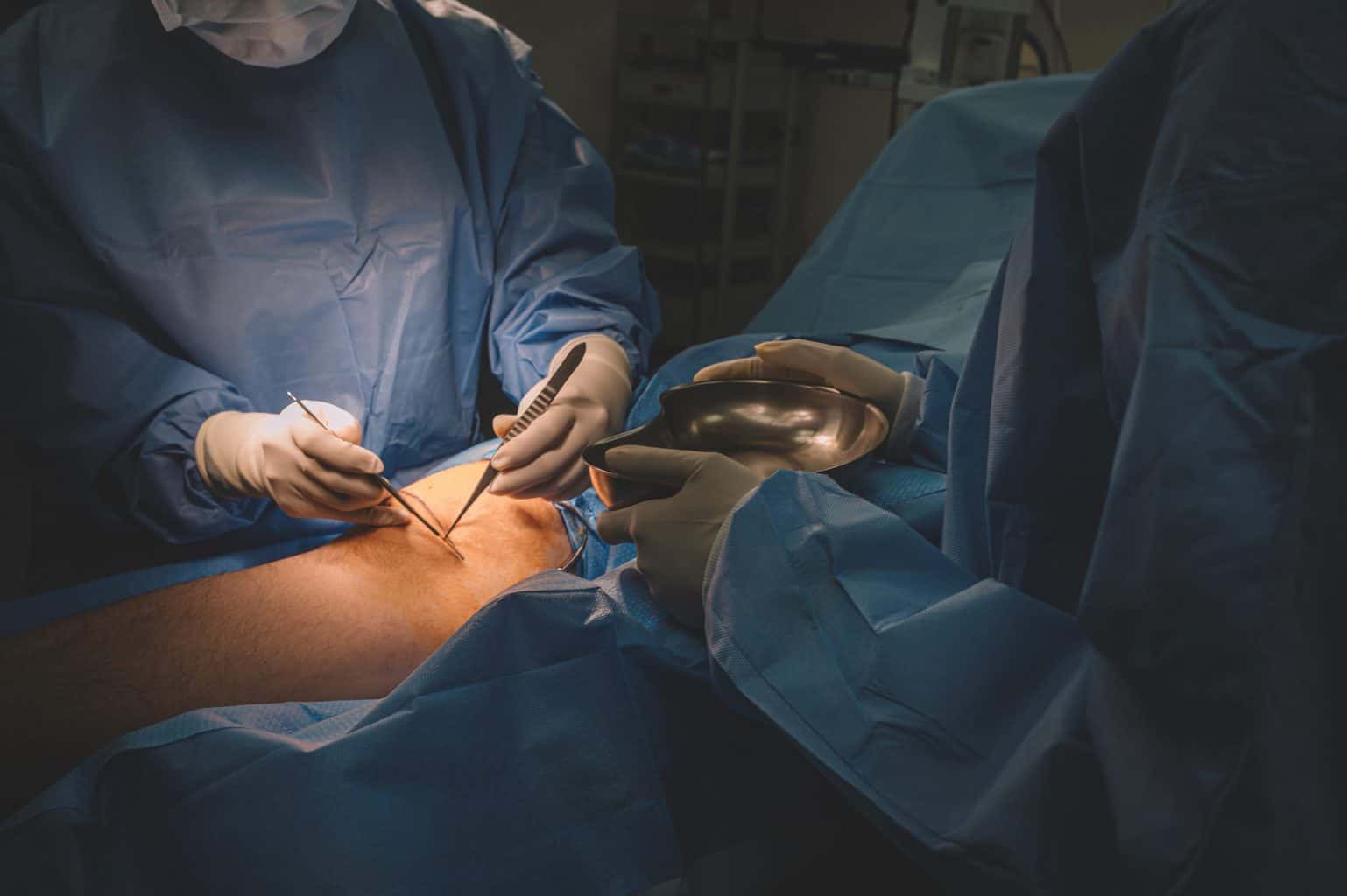 vascular surgeons in the operating theater, vein issues, vascular treatment, aortoiliac occlusive disease radiology, aortoiliac disease radiology, vein surgery