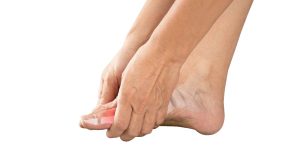 person with gout massaging feet, get out gout, treatment for gout, uric acid driver of gout, rheumatology treatment for gout, diet modification treatment for gout