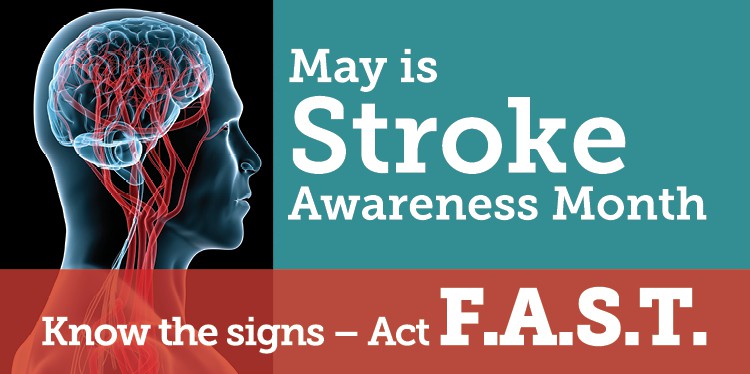 may is stroke awareness month, face drooping, arm weakness, speech difficulty, time to call 911, fast, donna lindsay, symptoms of stroke