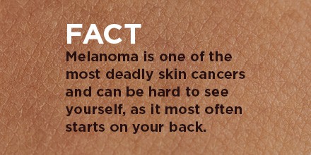 Melanoma Monday Skin Cancer